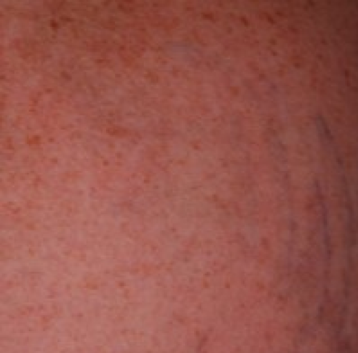 Before/After Image